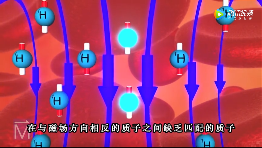 MRI是如何成像的